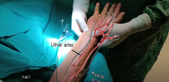 Üretra Darlığı için En İyi Doktor Kimdir